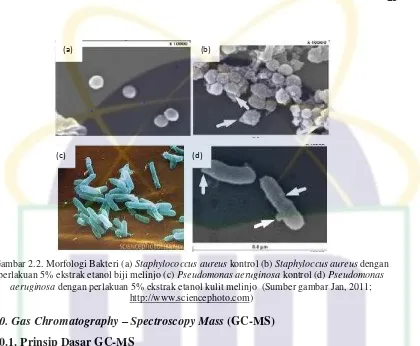Gambar 2.2. Morfologi Bakteri (a) Staphylococcus aureus kontrol (b) Staphyloccus aureus dengan 
