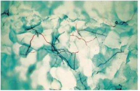 Gambar 2.3. Gambaran Dermatofita pada Pemeriksaan Mikroskop (A) Penampang Hasil  Kerokan Lesi Kulit Kepala dengan KOH yang Menunjukkan Hifa, (B) Hasil Kultur yang  Memperlihatkan Hifa, Makrokonidia, dan Mikrokonidia th