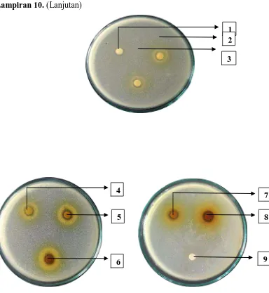 Gambar hasil uji aktivitas antibakteri fraksi n-heksan daun mindi (Melia azedarach L.) terhadap bakteri Staphylococcus aureus 