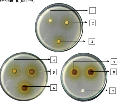 Gambar hasil uji aktivitas antibakteri fraksi etilasetat daun mindi ( Melia azedarach L.) terhadap bakteri Escherichia coli 