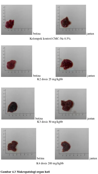 Gambar 4.3 Makropatologi organ hati