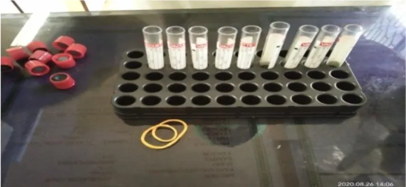 Gambar 2: Tabung reaksi yang akan dimasukkan filtrat nanas 
