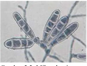 Gambar 2.2. Mikroskopis Epidermophyton floccosum