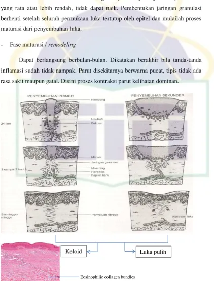 Gambar 2.1.  Proses Penyembuhan Luka12 