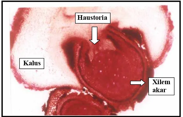 Gambar 2 :  Contoh penampang lintang mikroskopis haustoria akar cendana 