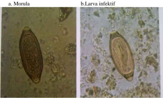 Gambar 2. Morfologi Telur Cacing Trichuris trichiura  2.3.2  Siklus Hidup Trichuris trichiura 