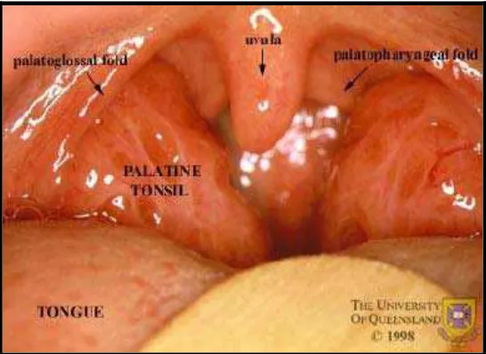 Gambar 2.4:Tonsila Palatina dan struktur sekitarnya 
