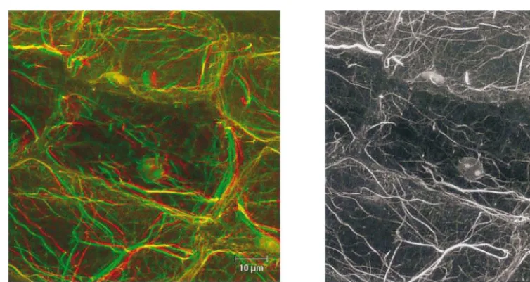 Fig. 4. Laser scanning confocal ﬂuorescence microscope image of pea stem tissue stained with rhodamine-phalloidin