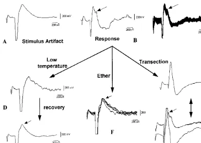 Fig. 3. Recordings of the response. (A) Only stimulus artifact, which marks the point of stimulation, can be seen at low intensityof stimulation