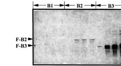 Fig. 2. Expression of fusion proteins in bacterial cells. E. coli,BL21 (DE3) harboring each expression vector was grown at37°C for 1–3 h after addition of 1 mM IPTG