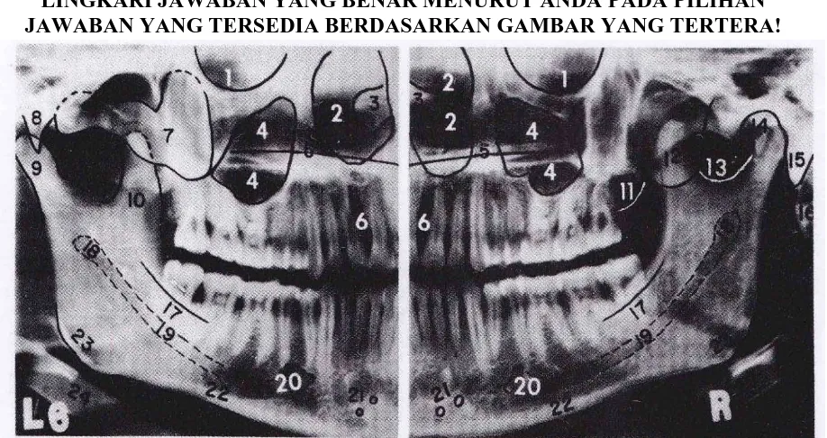 Gambar Radiografi Panoramik 