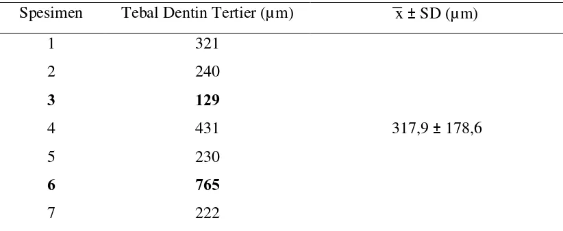Tabel 1. Hasil Pengukuran Ketebalan Dentin Tertier Pada Gigi Molar Pertama Bawah Permanen  Penyirih Suku Karo di Pancur Batu Medan 