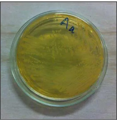Gambar 15. Biakan murni Aggregatibacter        actinomycetemcomitans 