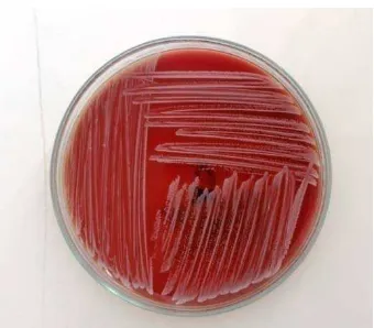 Gambar 10. Streptococcus mutans ATCC 25175 