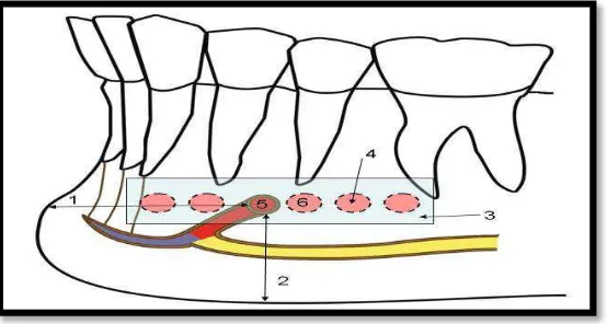 Gambar 2 . Anatomi variasi posisi foramen mentale pada bidang horizontal dalam hubungannya dengan akar gigi.4  