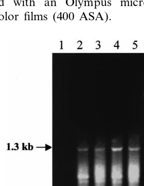 Fig. 1. Ampliﬁcation of AtENT1 cDNA by RT-PCR. PCRwas performed without template (1) or with RT mixture(2–5)