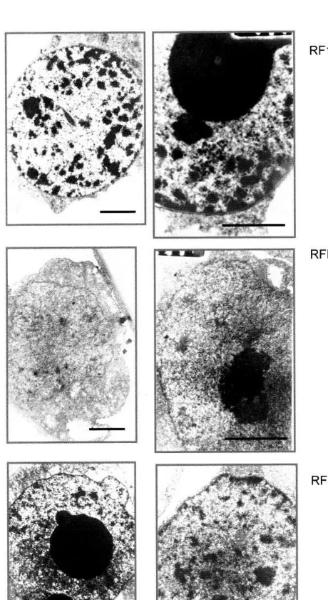 Fig. 5. Transmission electron microphotographs of nuclei ofdifferent BY-2 cell lines. Magniﬁcation: left side, 8000×;right side, 14 000×