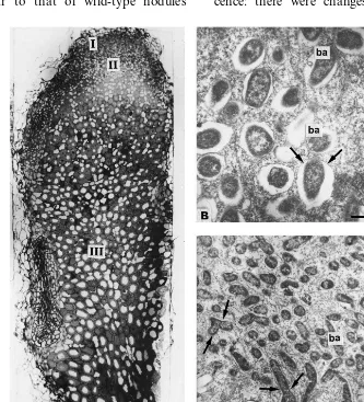 Fig. 1. Nodule structural organisation of cv. Finale: (A) longitudinal nodule section; (B) plant cells in zone II containing juvenilebacteroids; (C) plant cells in zone III containing differentiated bacteroids