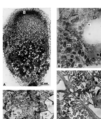 Fig. 3. Nodule structural organisation of mutants RisFixL and RisFixO: (A) longitudinal nodule section; (B) plant cells containinginfection threads and ‘juvenile’ bacteroids; (C) Symbiosomes containing several bacteroids in central part of the nodule; (D)d