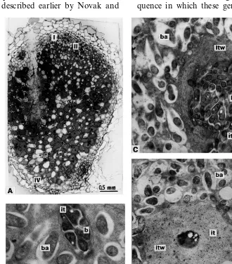 Fig. 5. Nodule structural organisation of mutant RisFixV: (A) longitudinal nodule section; (B) plant cells containing infectionthreads and ‘juvenile’ bacteroids; structure of infection thread with increased walls of surrounding plant cells in zone III (C) 