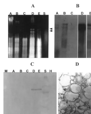Fig. 2. Subcellular localisation of cherry leaf roll nepovirus (CLRV) by differential centrifugation of tobacco infected leaves