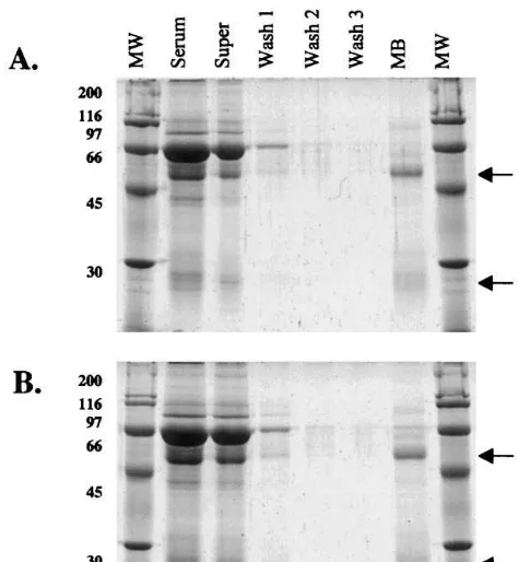 Fig. 2. A. Western blot of Pistiaextract incubated with magnetic bead puriﬁed anti-CRT.Breakdown product is very minor in non-frozen samples