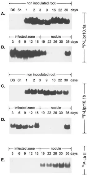 Fig. 3. Northern analysis of L. luteus total RNA of dry seeds (DS) and developing root (from 6 h after imbibition up to 30 days)