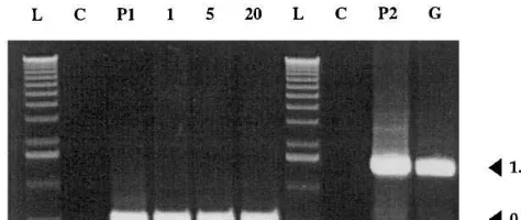 Fig. 2. PCR analysis of transgenic pear plants. Gel elec-trophoresis of5 and 20; lane G, GUS transgenic line; lane L, molecular attacin E and uidA gene PCR products; lane C,non-transformed plant; lanes P1 and P2, plasmids pFM3002and pFAJ3000; lanes 1, 5 an