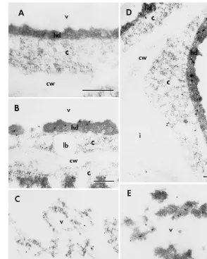 Fig. 2. Electron micrographs of cultured immature embryo cotyledons. Immature zygotic embryo cotyledons (3–5 mm) of asoybean triple LOX null mutant grown in greenhouse were cultured on 10 mg/L NAA