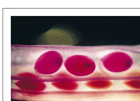 Fig. 3. Light microscope image of a silique from seeds are stained pink/purple with fuchsin-red