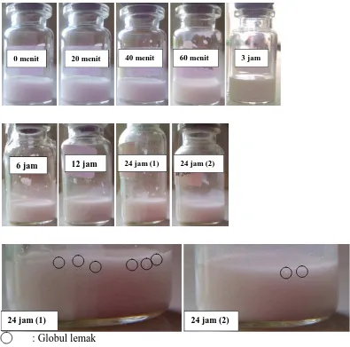 Gambar 4.4a Penampilan fisik Intralipid 20% yang dicampur dengan infus larutan natrium klorida 0,9% dalam satu wadah selama 24 jam 