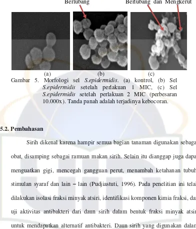 Gambar 5. Morfologi sel S.epidermidis. (a) kontrol, (b) Sel 