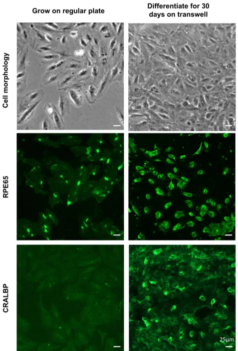 Figure  2.5  ARPE19  cells  develop  RPE  phenotype  characteristics  and  express  RPE- RPE-specific protein markers, RPE65 and CRALBP