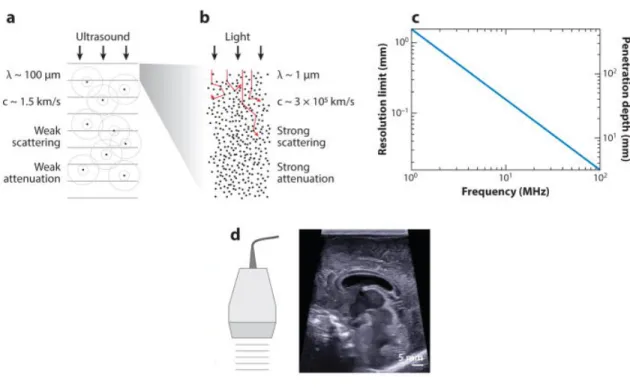 Figure 1 – Adapted and reproduced from Maresca D., et al (2018) 5 , Properties and  applications of ultrasound waves