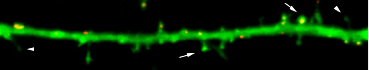 Figure 1.5: Snapshot of spine maturation. Dendrite of a 10 DIV GFP-expressing neurons (green) stained for PSD-95 (red)