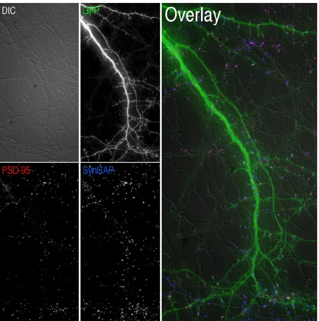 Figure 2.3: Four-channel image of neuronal dendrites. Representative image of neuronal dendrites obtained with a Zeiss Axiovert 200 Microscope