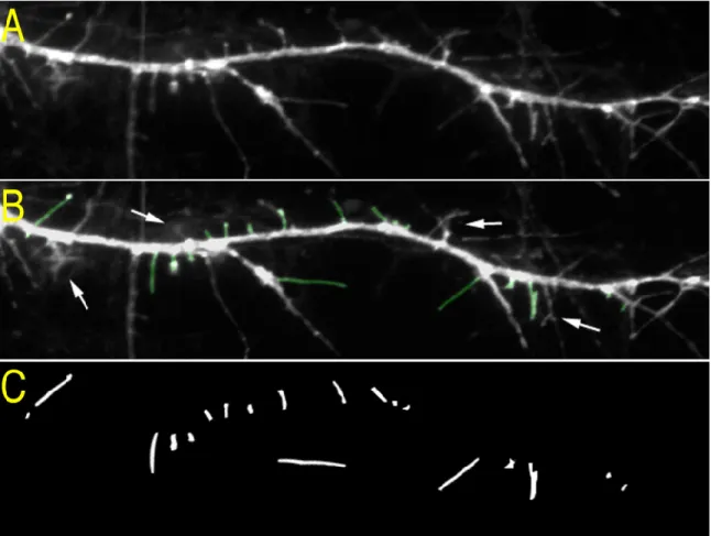 Figure 2.4: Creating the protrusion mask. (A) Example of a dendritic branch and protrusions visualized in the channel