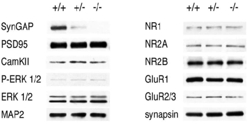 Figure 6.2: Western blot analysis of P1 brain homogenates. Postnatal day 1 mouse brains were homogenized and protein levels were analyzed by Western blot