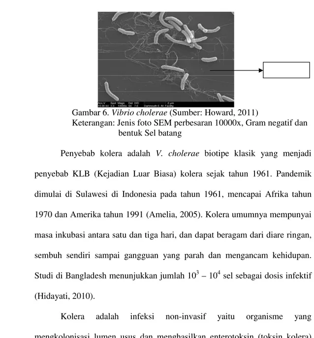 Gambar 6. Vibrio cholerae (Sumber: Howard, 2011)