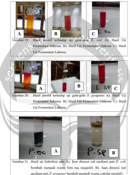   Gambar 19. Hasil positif terhadap uji gula-gula E. coli A). Hasil Uji 