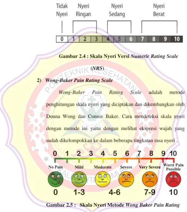 Gambar 2.4 : Skala Nyeri Versi Numeric Rating Scale    (NRS) 
