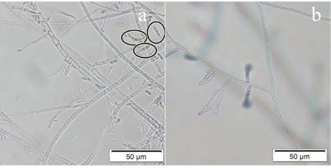 Gambar 1. Foto mikroskopis jamur F. moniliforme dengan perbesaran 400x;  (a) Makrokonidia, (b) Mikrokonidia (Pratiwi et al., 2013)  