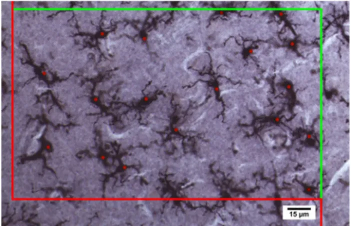 Figure 1 depicts the stereological method and photomi- photomi-crograph of the microglial quantification method in a brain of an individual with autism