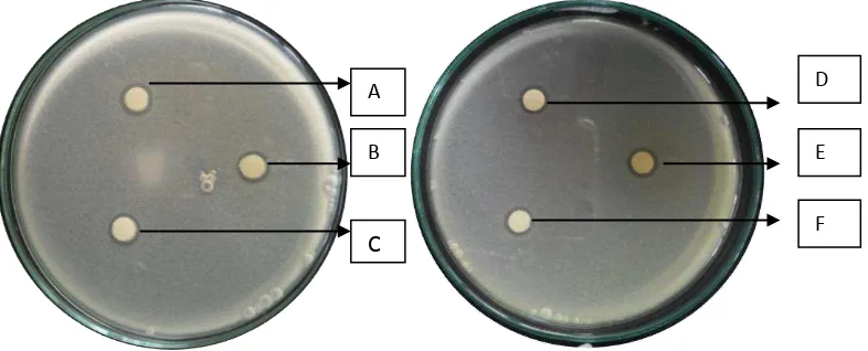 Gambar 4.1 Hasil uji aktivitas kombinasi antibakteri ekstrak etanol daun sirih dengan amoksisilin terhadap bakteri Staphylococcus aureus 