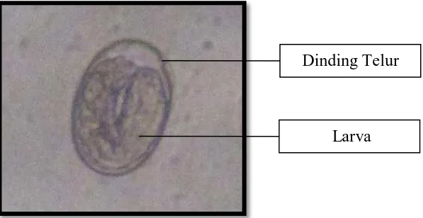 Gambar 4.3. Telur Parasit Strongyloides westeri  yang ditemukan pada Gastrointestinal Kuda di Berastagi (perbesaran 400x) 