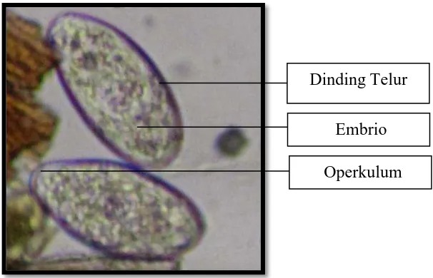 Gambar 4.4. Telur Parasit Ascaris equorum  yang ditemukan pada Gastrointestinal Kuda di Berastagi (perbesaran 400x) 
