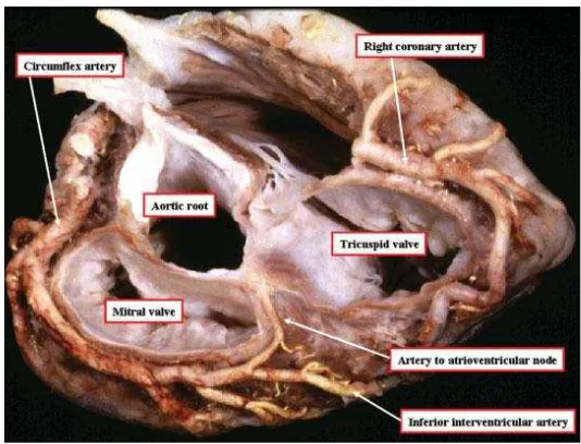 Gambar 8. Aliran arteri coronaria menuju otot-otot papillaris  