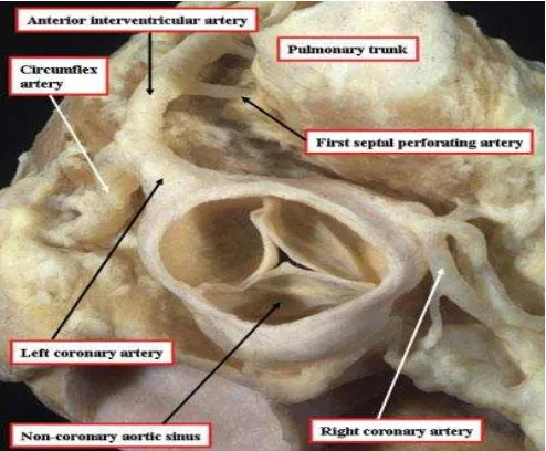 Gambar 3. Letak percabangan arteri coronaria pada sinus aorticus dibandingkan                          dengan organ lain 