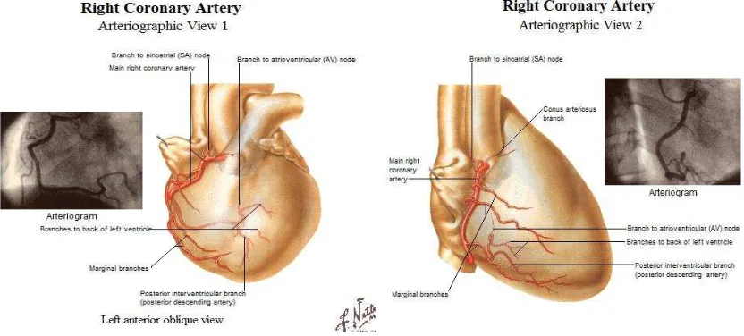Gambar 4. Arteriogram dari arteri coronaria kiri  