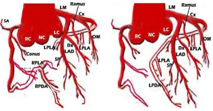 Gambar 7.  Jenis dominan arteri coronaria kanan (kiri) dan jenis dominan arteri coronaria kiri (kanan)
